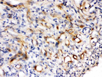 Nestin Antibody