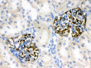 Nestin Antibody