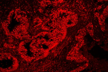 nmt55/p54nrb/NONO Antibody
