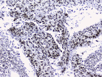 nmt55/p54nrb/NONO Antibody
