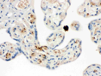NAP2/PPBP Antibody