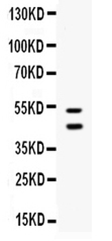 EPCR/CD201/PROCR Rabbit Polyclonal Antibody