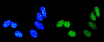 Rab9/RAB9A Rabbit Polyclonal Antibody