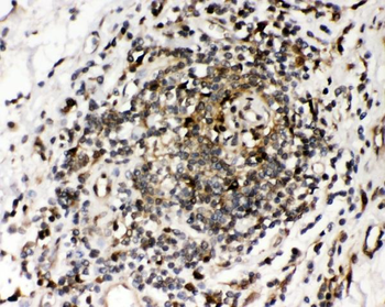 Ribonuclease Inhibitor/RNH1 Antibody