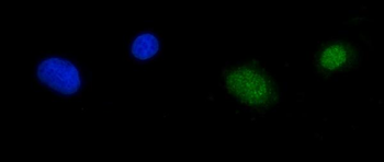 RPA70/RPA1 Rabbit Polyclonal Antibody