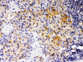 SKAP55/SKAP1 Antibody