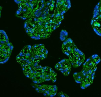 GLUT9/SLC2A9 Rabbit Polyclonal Antibody