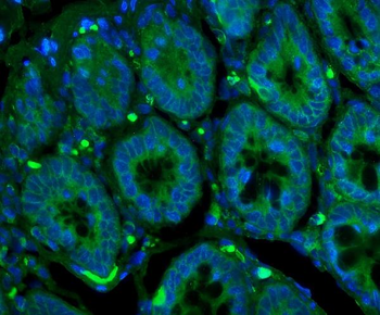 GLUT9/SLC2A9 Rabbit Polyclonal Antibody