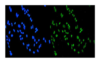 SMURF1 Rabbit Polyclonal Antibody