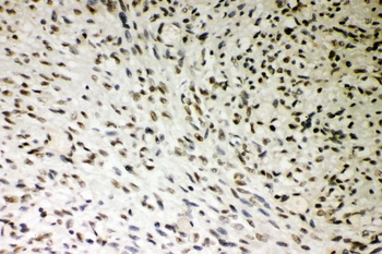 SMURF1 Rabbit Polyclonal Antibody