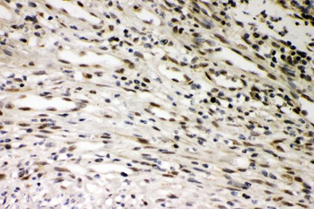SMURF1 Rabbit Polyclonal Antibody