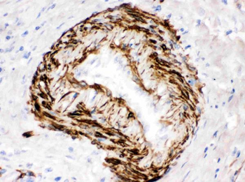 SMYD3 Rabbit Polyclonal Antibody