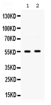 SMYD3 Rabbit Polyclonal Antibody