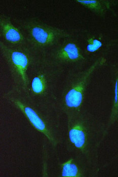 SPTLC1 Rabbit Polyclonal Antibody