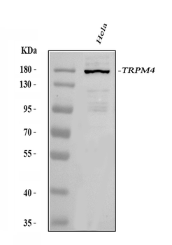 TRPM4 Rabbit Polyclonal Antibody