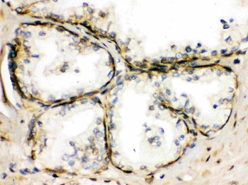 TRPM5 Rabbit Polyclonal Antibody