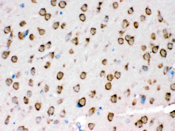 TRPM5 Rabbit Polyclonal Antibody