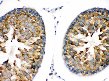 TRPM5 Rabbit Polyclonal Antibody