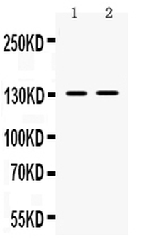 TRPM5 Rabbit Polyclonal Antibody