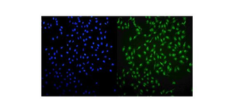 UHRF1 Rabbit Polyclonal Antibody