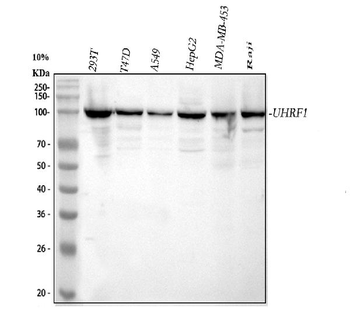 UHRF1 Rabbit Polyclonal Antibody