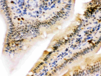 NIRF/UHRF2 Rabbit Polyclonal Antibody
