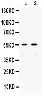 XRCC4 Rabbit Polyclonal Antibody