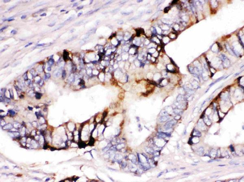 ZP2 Rabbit Polyclonal Antibody