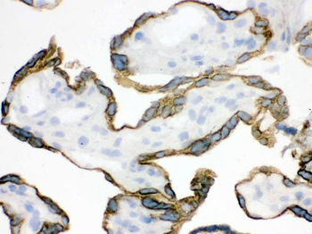 ZP2 Rabbit Polyclonal Antibody