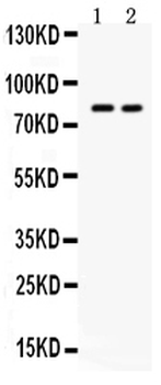 ZP2 Rabbit Polyclonal Antibody