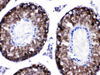 SIAH Interacting Protein/CACYBP Antibody