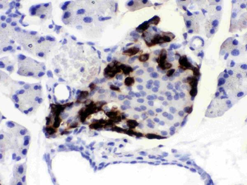 VIP peptides VIP Rabbit Polyclonal Antibody