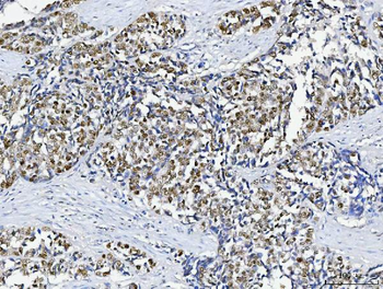 ABL2 Rabbit Polyclonal Antibody