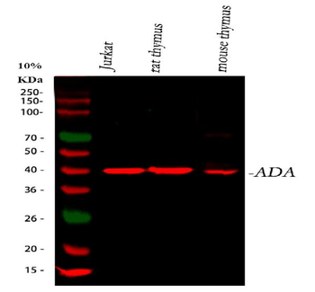 ADA Rabbit Polyclonal Antibody