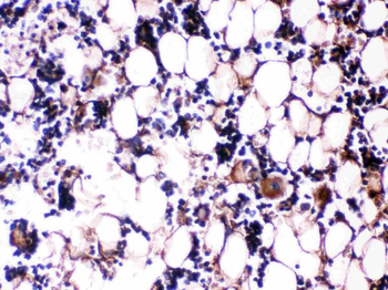 Osteocalcin/BGLAP Rabbit Polyclonal Antibody