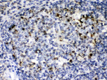 GC1q R/C1QBP Rabbit Polyclonal Antibody