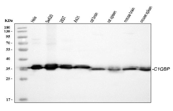 GC1q R/C1QBP Rabbit Polyclonal Antibody