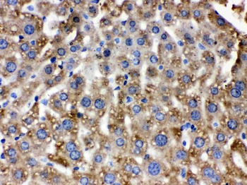 Catalase Rabbit Polyclonal Antibody