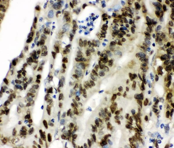 CCT3 Antibody