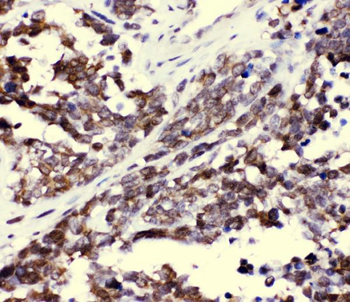 CCT3 Antibody