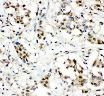 CCT3 Antibody