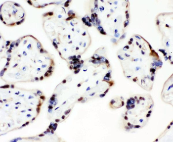 CCT3 Antibody