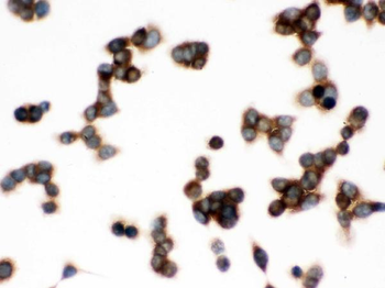 TCP1 delta/CCT4 Antibody