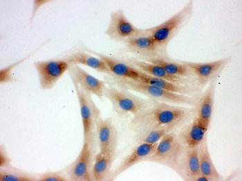 TCP1 delta/CCT4 Antibody