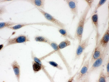 TCP1 delta/CCT4 Antibody