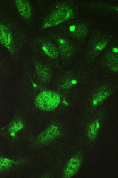 TCP1 delta/CCT4 Antibody