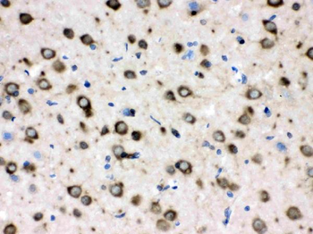 TCP1 delta/CCT4 Antibody