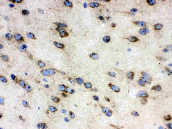 TCP1 delta/CCT4 Antibody