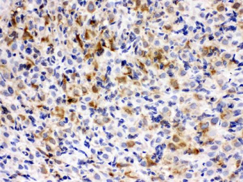 TCP1 epsilon/CCT5 Antibody