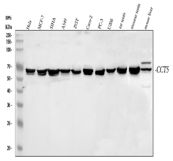 TCP1 epsilon/CCT5 Antibody